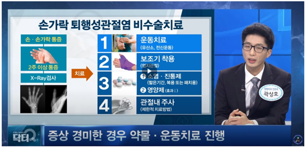 손가락 퇴행성 관절염 치료방법